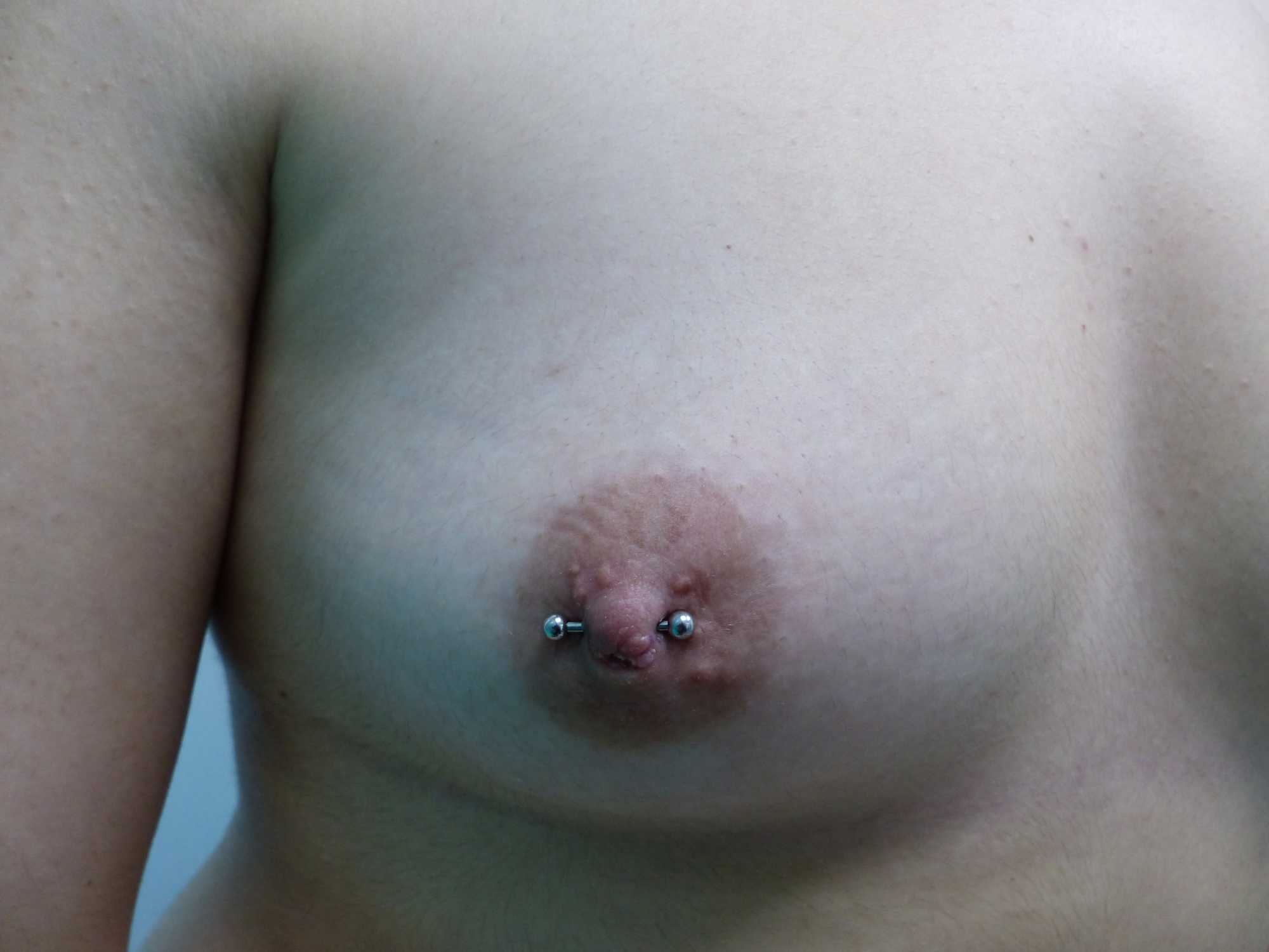 Pezón Invertido piercing reparador