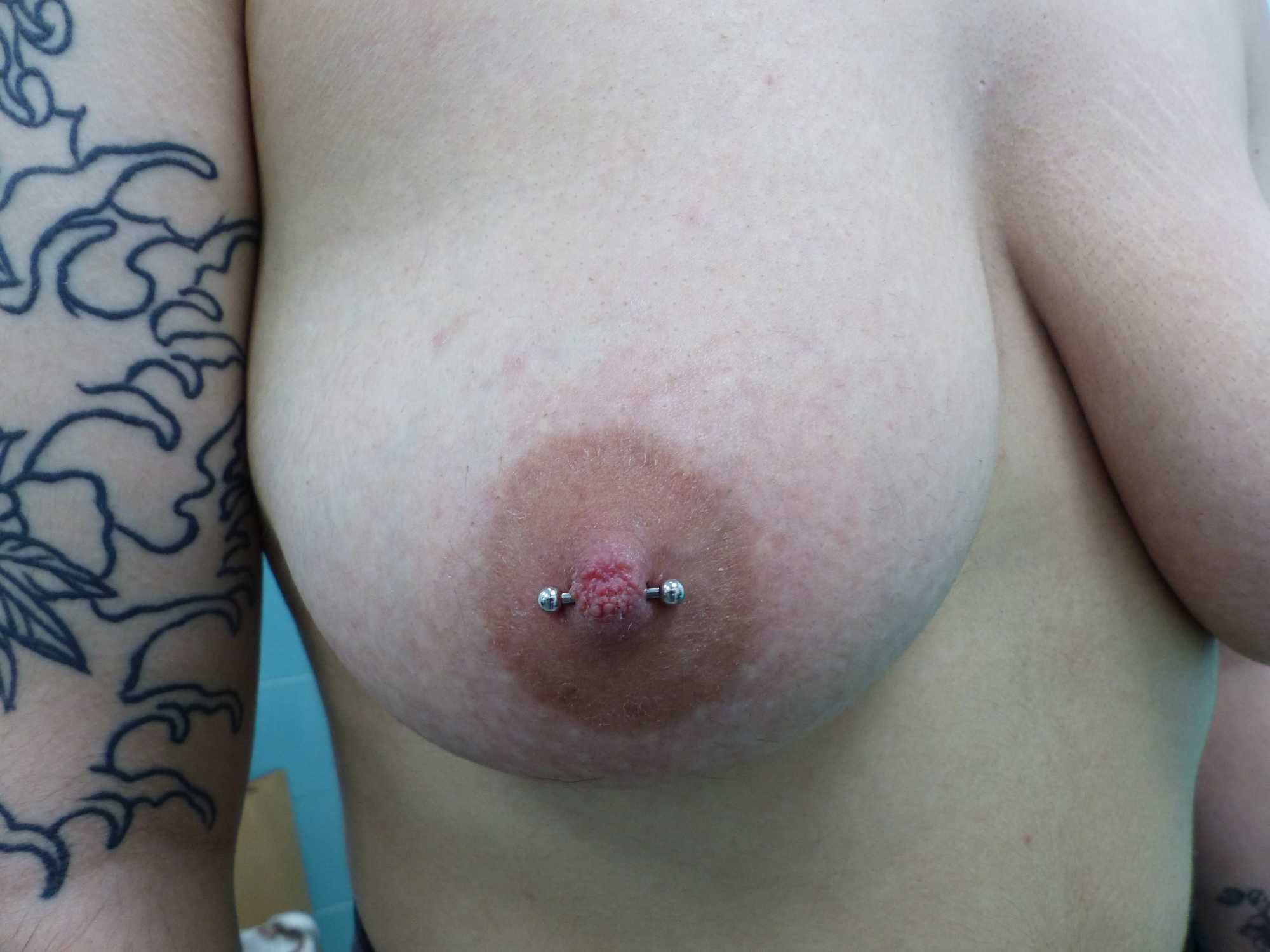 pezon plano piercing reparador